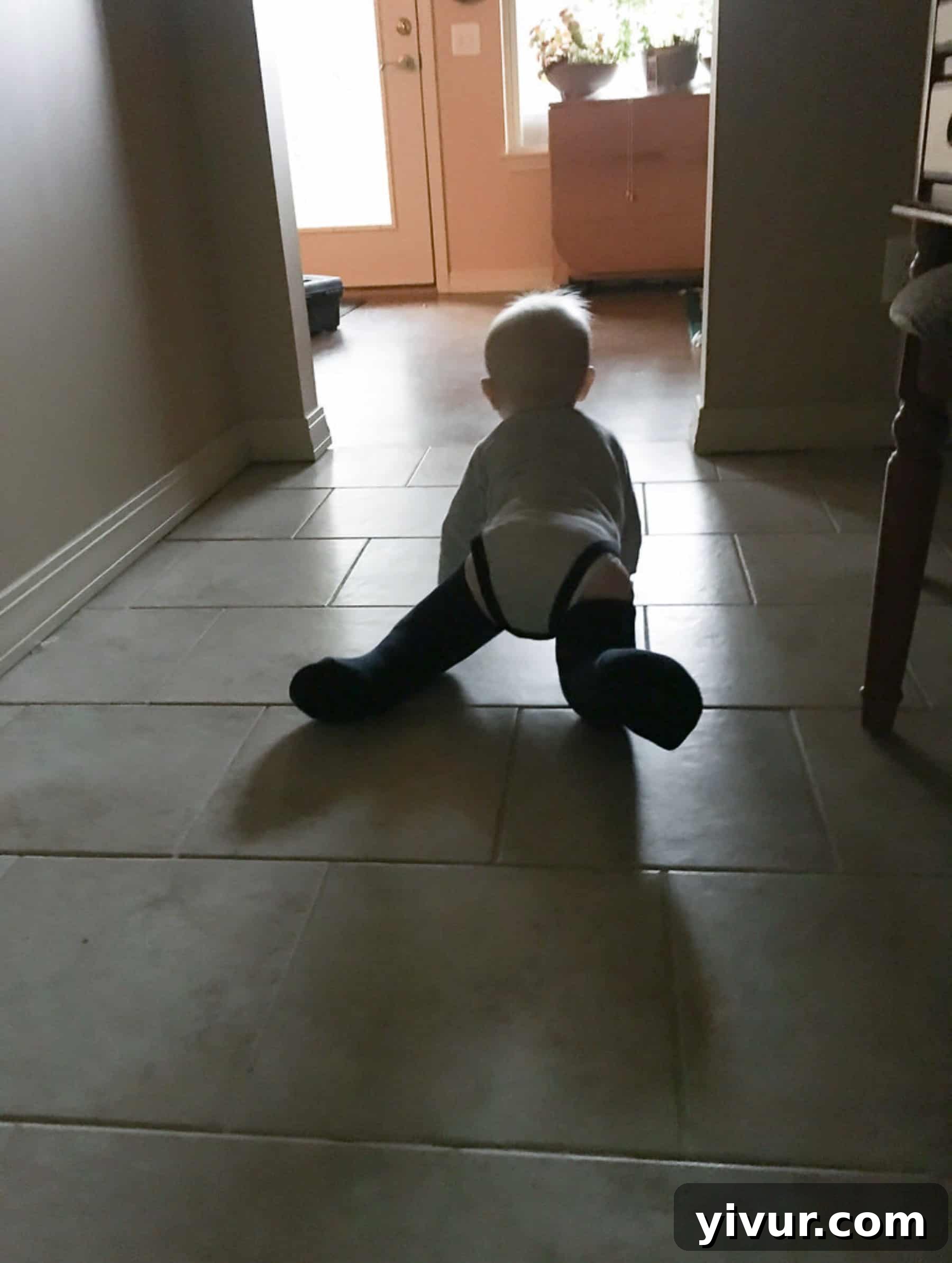 4 Yaşındaki Evladım Neden Alçıda ve Tekerlekli Sandalyede 19 Josh demonstrating his incredible adaptability, learning to crawl in full leg casts just hours after receiving them for his third round of clubfoot correction. His determination was truly inspiring.