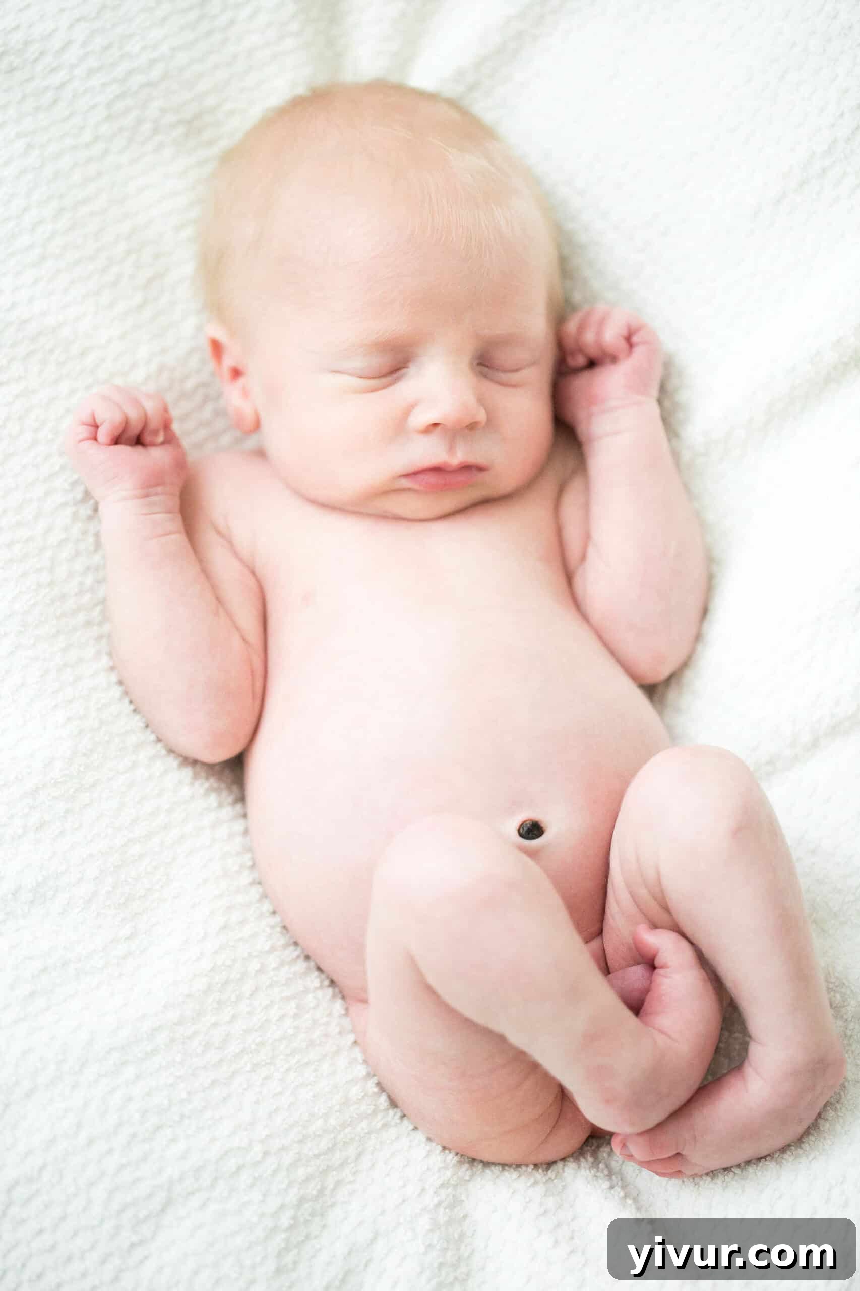 4 Yaşındaki Evladım Neden Alçıda ve Tekerlekli Sandalyede 4 Close-up of Josh's clubfeet bending sideways, illustrating how he would have walked on the outside edges without intervention. They had a unique, almost 'flipper-like' appearance.