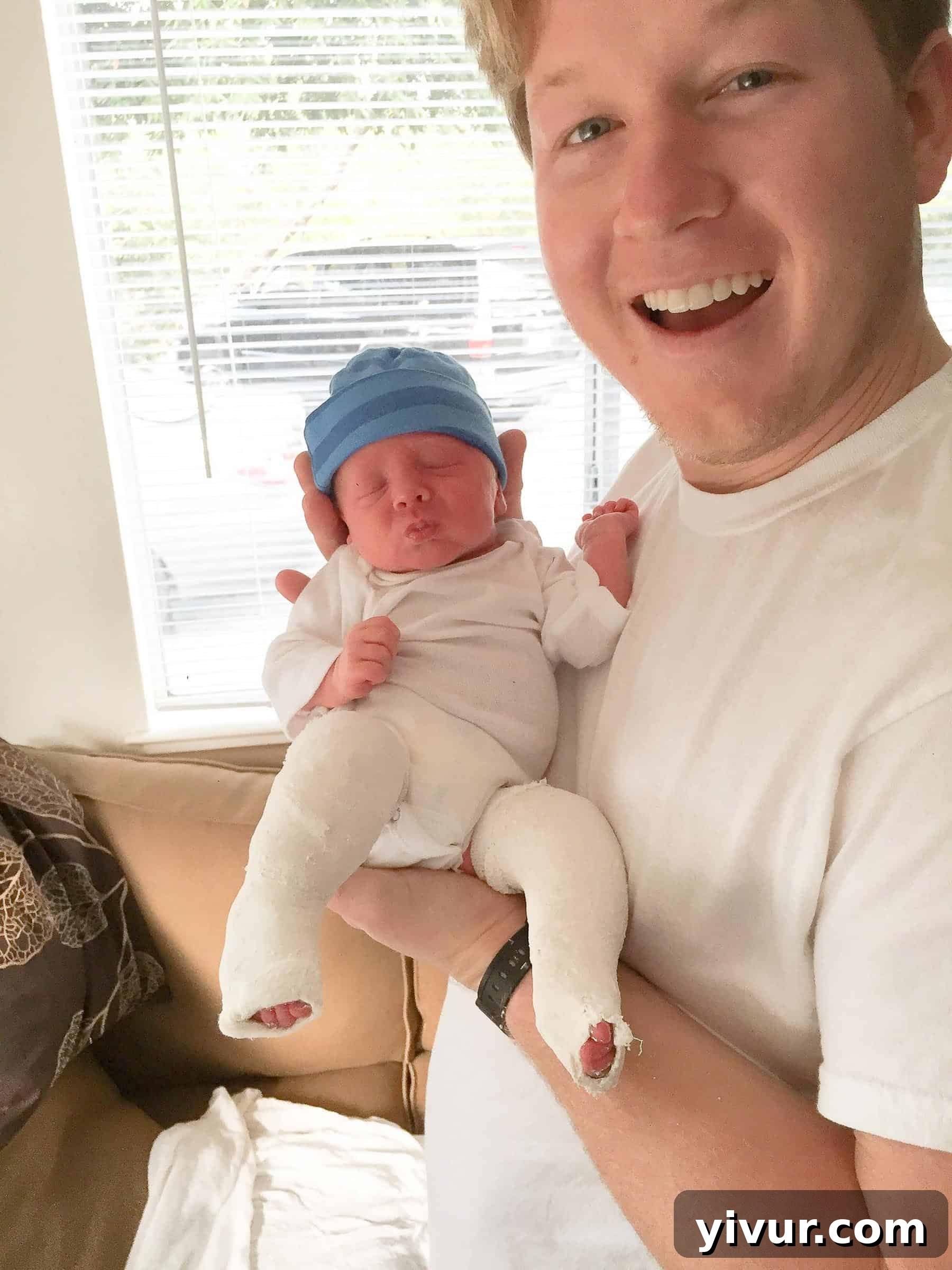 4 Yaşındaki Evladım Neden Alçıda ve Tekerlekli Sandalyede 5 Josh's very first set of casts, applied when he was just 13 days old. The casts were a critical part of his early clubfoot correction, gently reshaping his tiny feet.