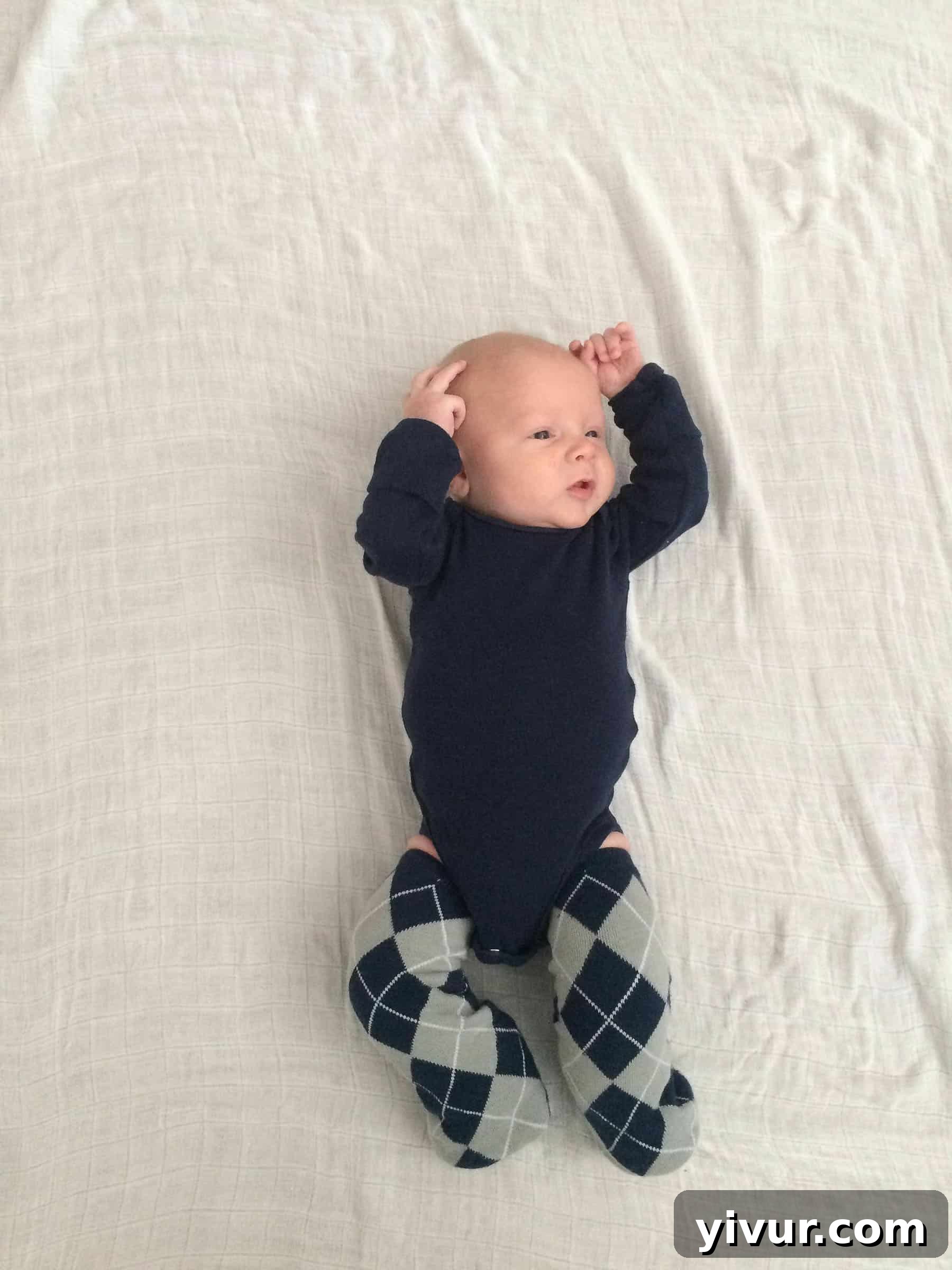 4 Yaşındaki Evladım Neden Alçıda ve Tekerlekli Sandalyede 6 Josh's casts cleverly hidden by baby leg warmers, a practical solution to maintain warmth and provide a sense of normalcy during his clubfoot treatment.