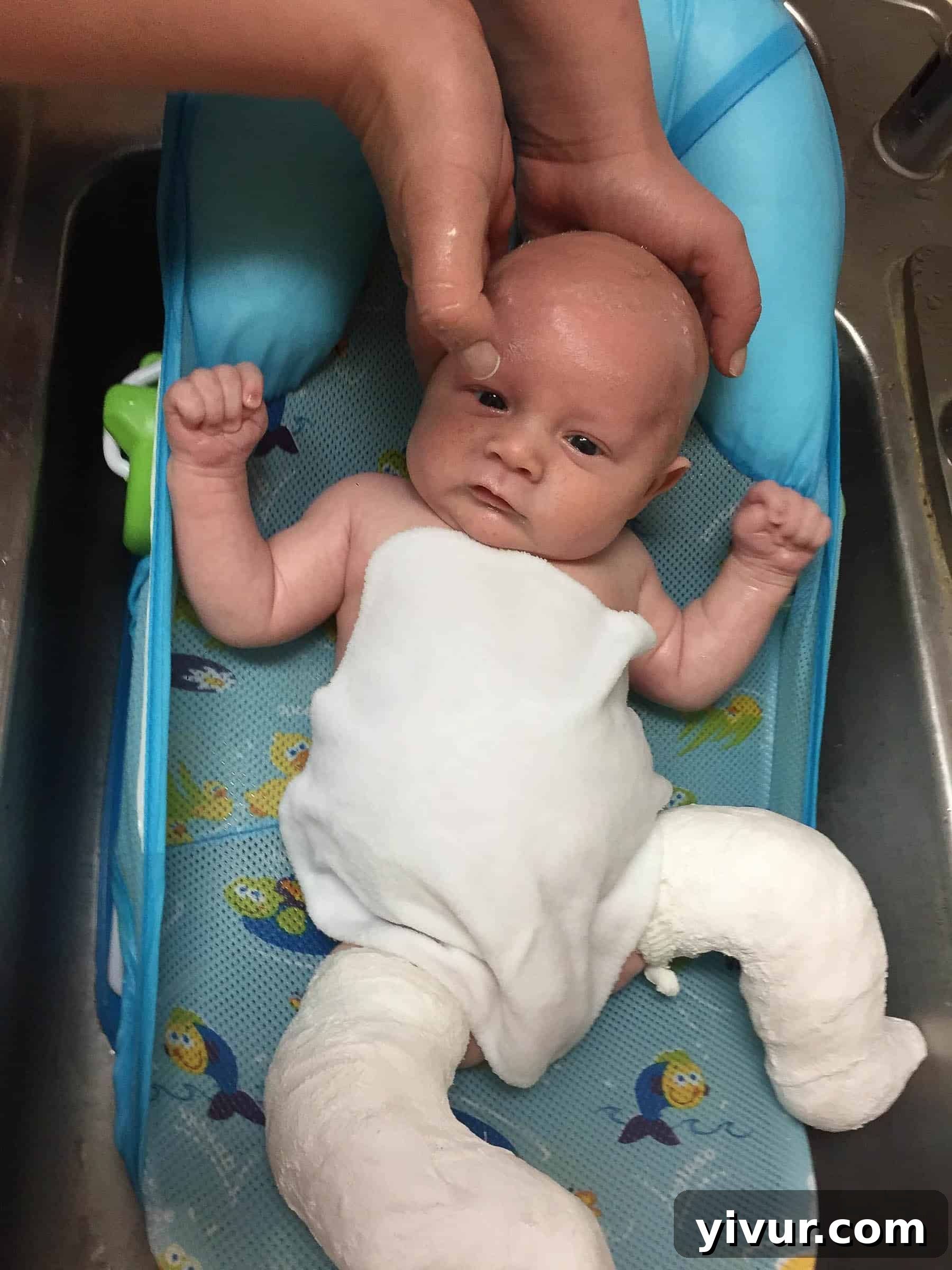 4 Yaşındaki Evladım Neden Alçıda ve Tekerlekli Sandalyede 7 A creative solution for bathing Josh while he was in casts, ensuring he remained warm and comfortable with warm washcloths.