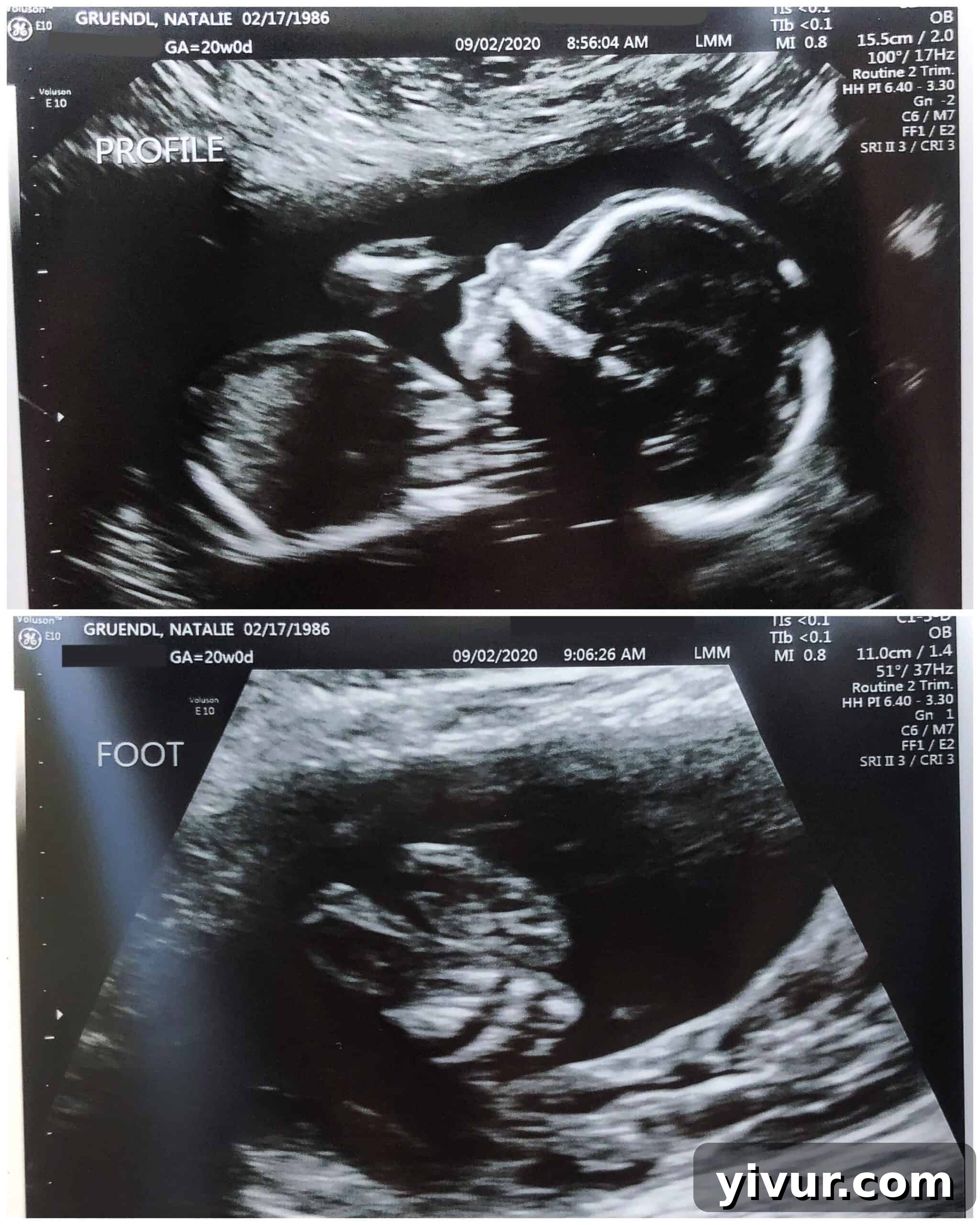 Mama's Must-Haves 3 Close-up ultrasound images showing a baby's profile and feet