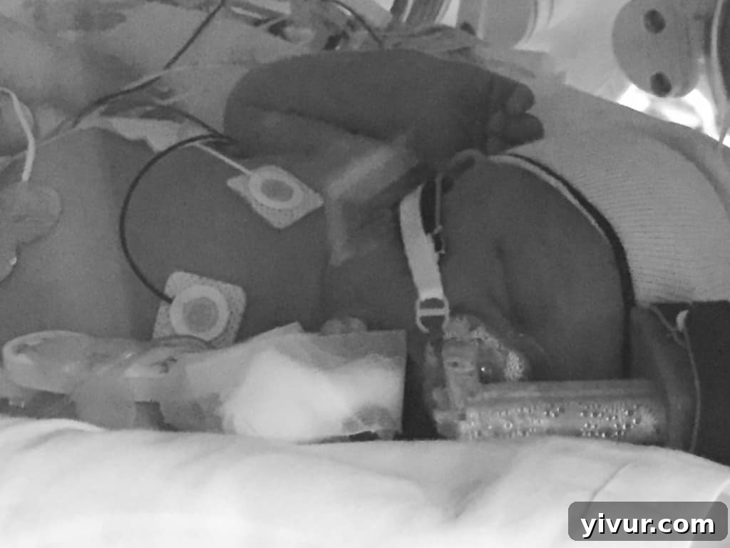 Newborn baby Josh with a CPAP machine and a knitted hat in the NICU