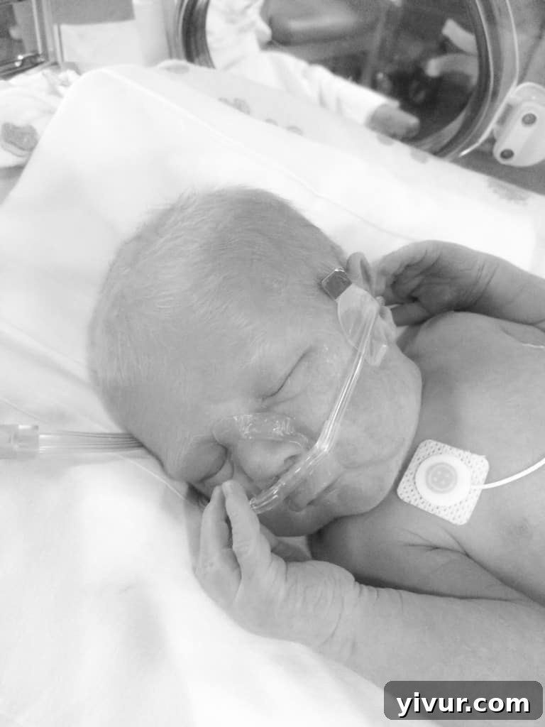 Newborn baby Josh in the NICU with a subtle oxygen line, showing progress