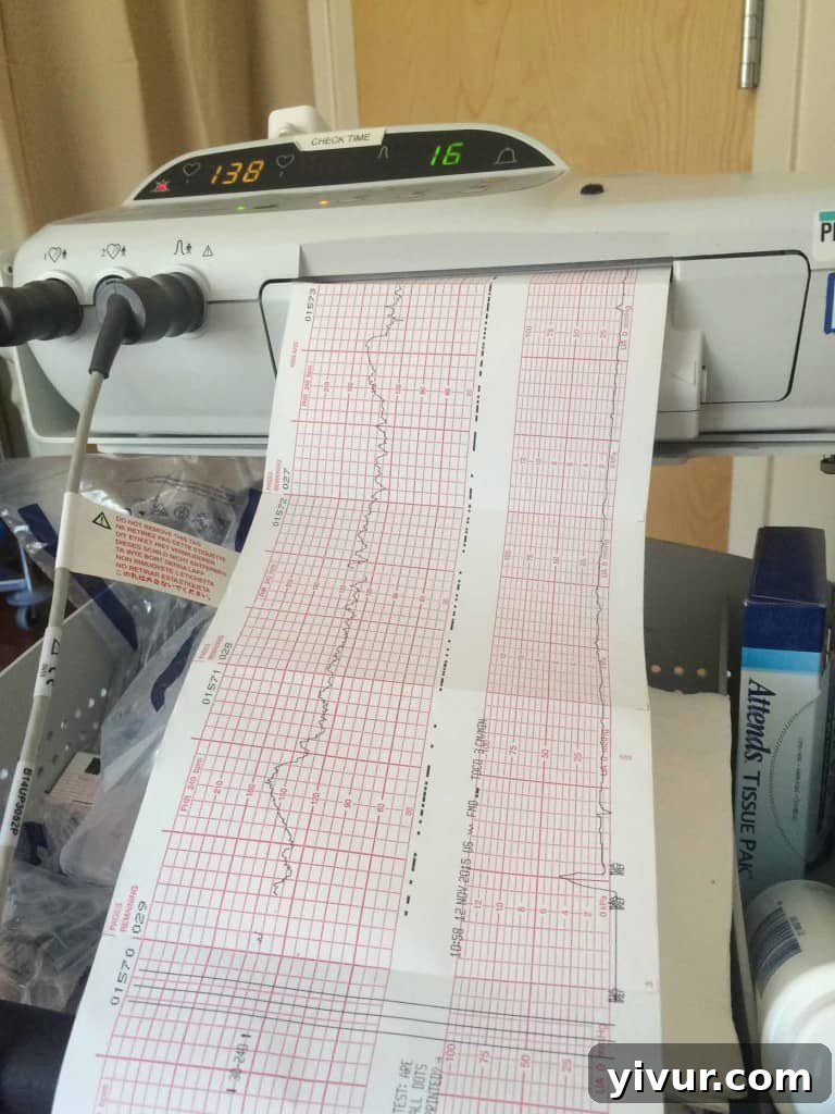 Pregnant belly with a baby heart rate monitor strapped on