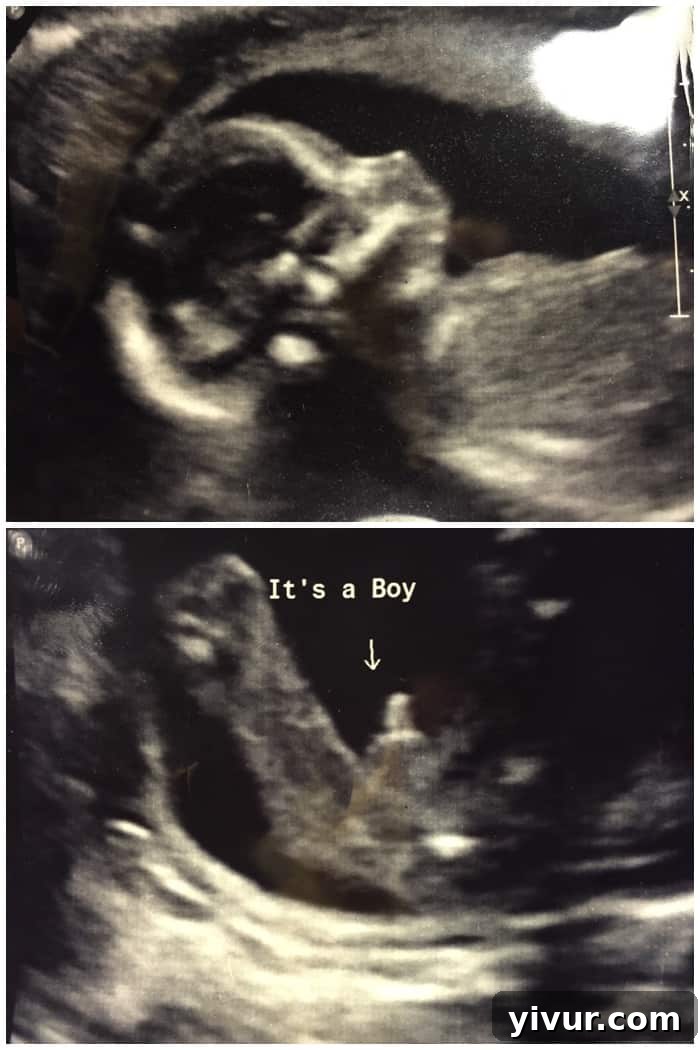 Second Trimester Guide: What to Expect Weeks 13–27 4 Gender Ultra Sound